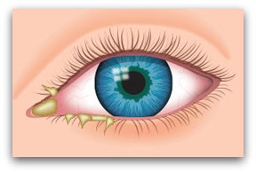 eye crust where do eye boogers come from eye crust where do eye boogers come from